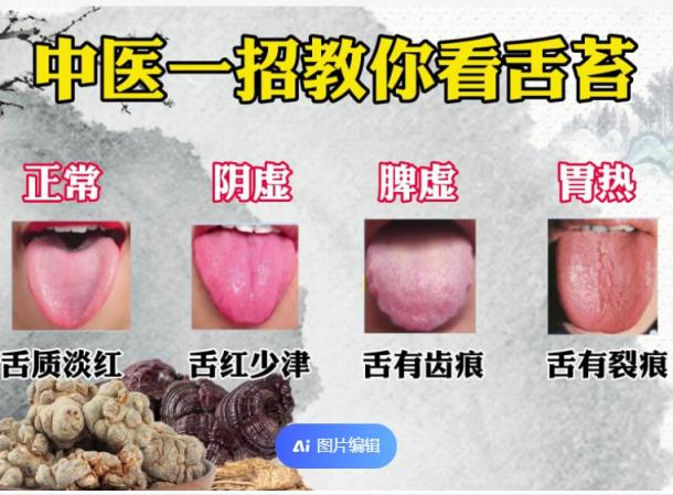 【千金舌诊】千金舌诊系统班22视频